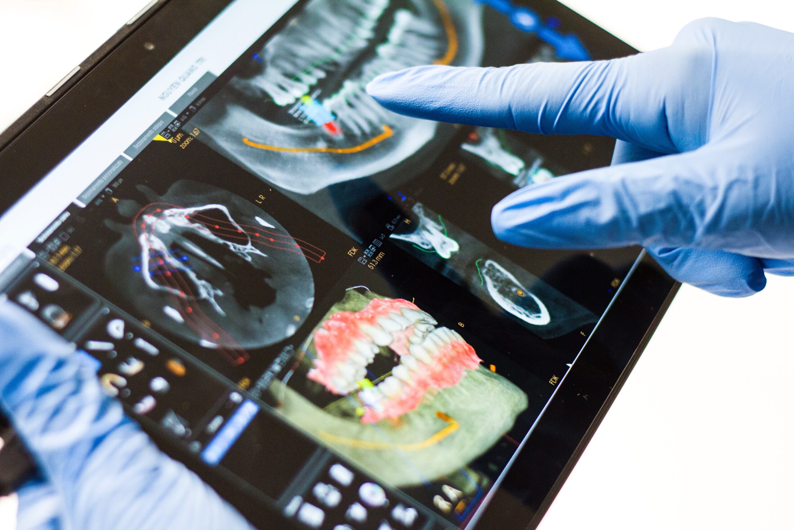 Lab CBCT Dental Scan